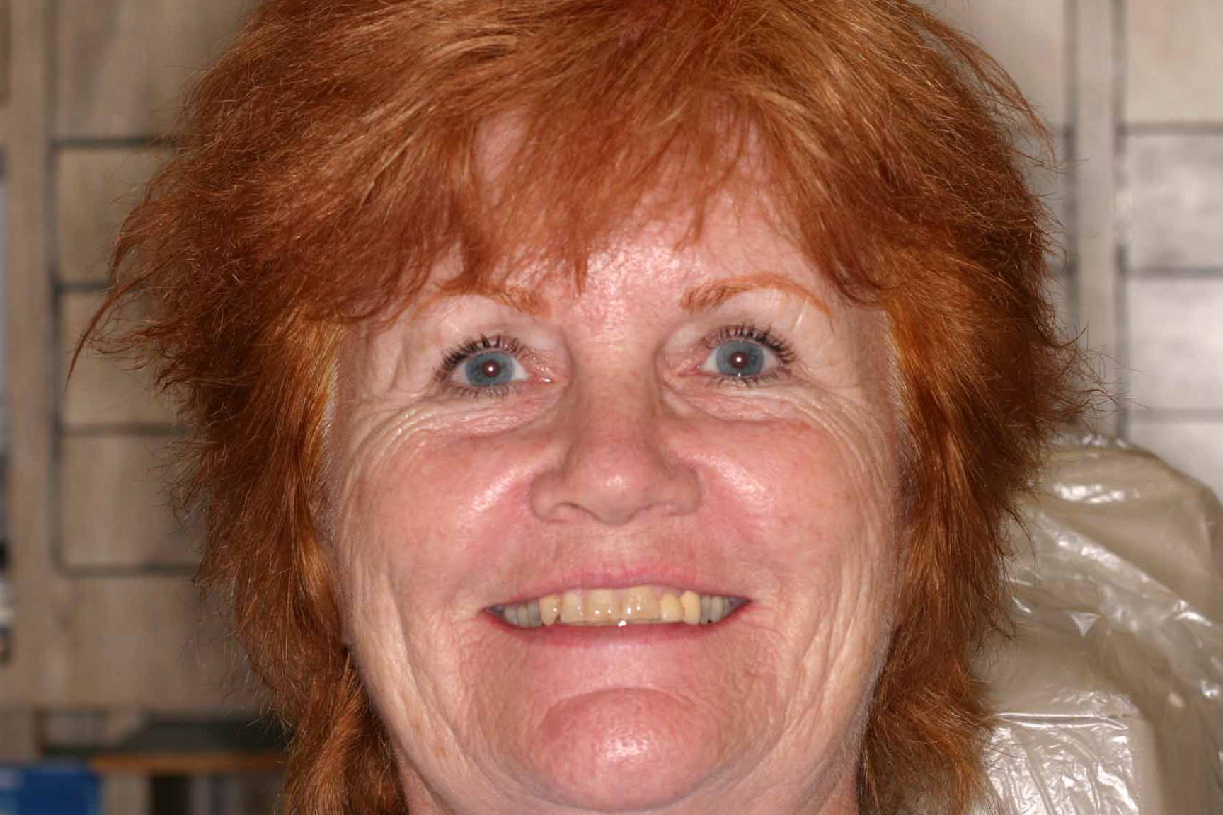 Cosmetic Dentist Fort Myers Cape Coral Naples FL